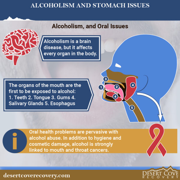 Alcoholism and Stomach Issues