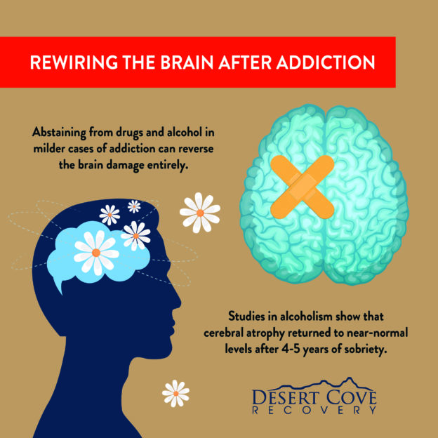 Neuroplasticity: Rewiring The Brain After Addiction | DCR