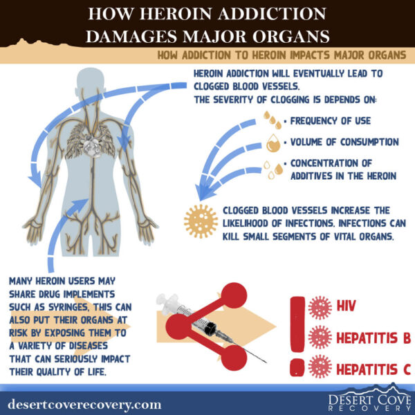 Effects of Heroin Use on Major Organs