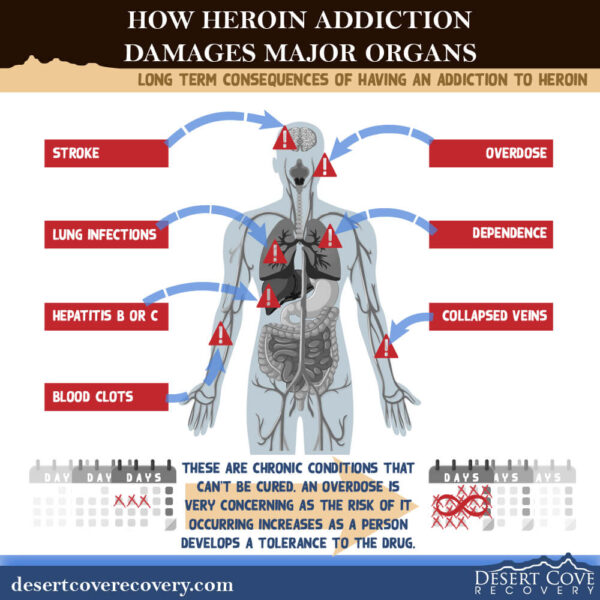 Long Term Effects of Heroin Addiction